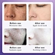 whitening freckle cream